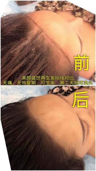 再生發(fā)效果展示一
