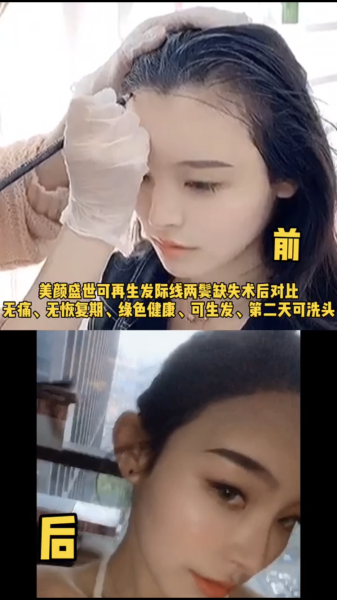 再生發(fā)效果對比五
