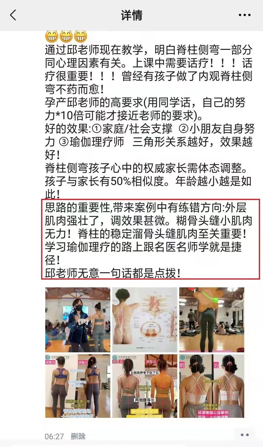 脊柱側彎反饋